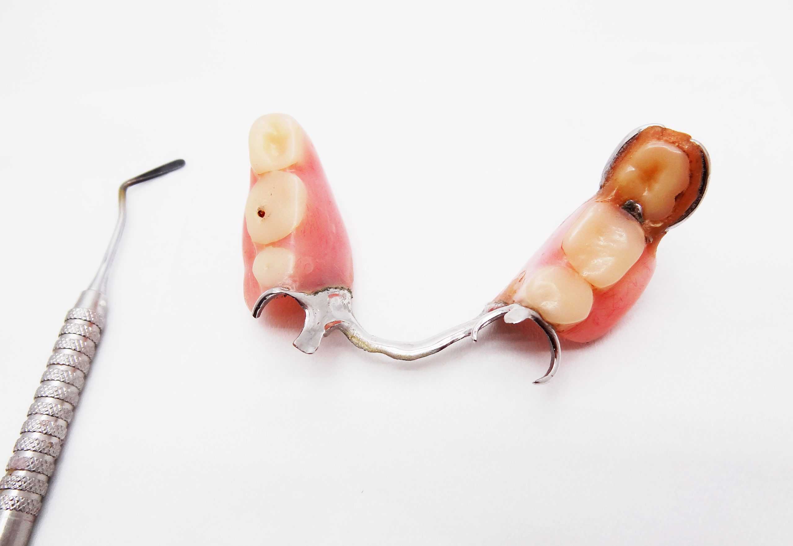 Old,denture,with,broken,clasp