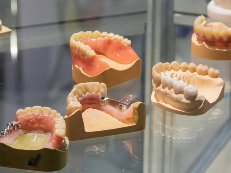 Featured image for “Denture Options: Finding the Right Fit for You”