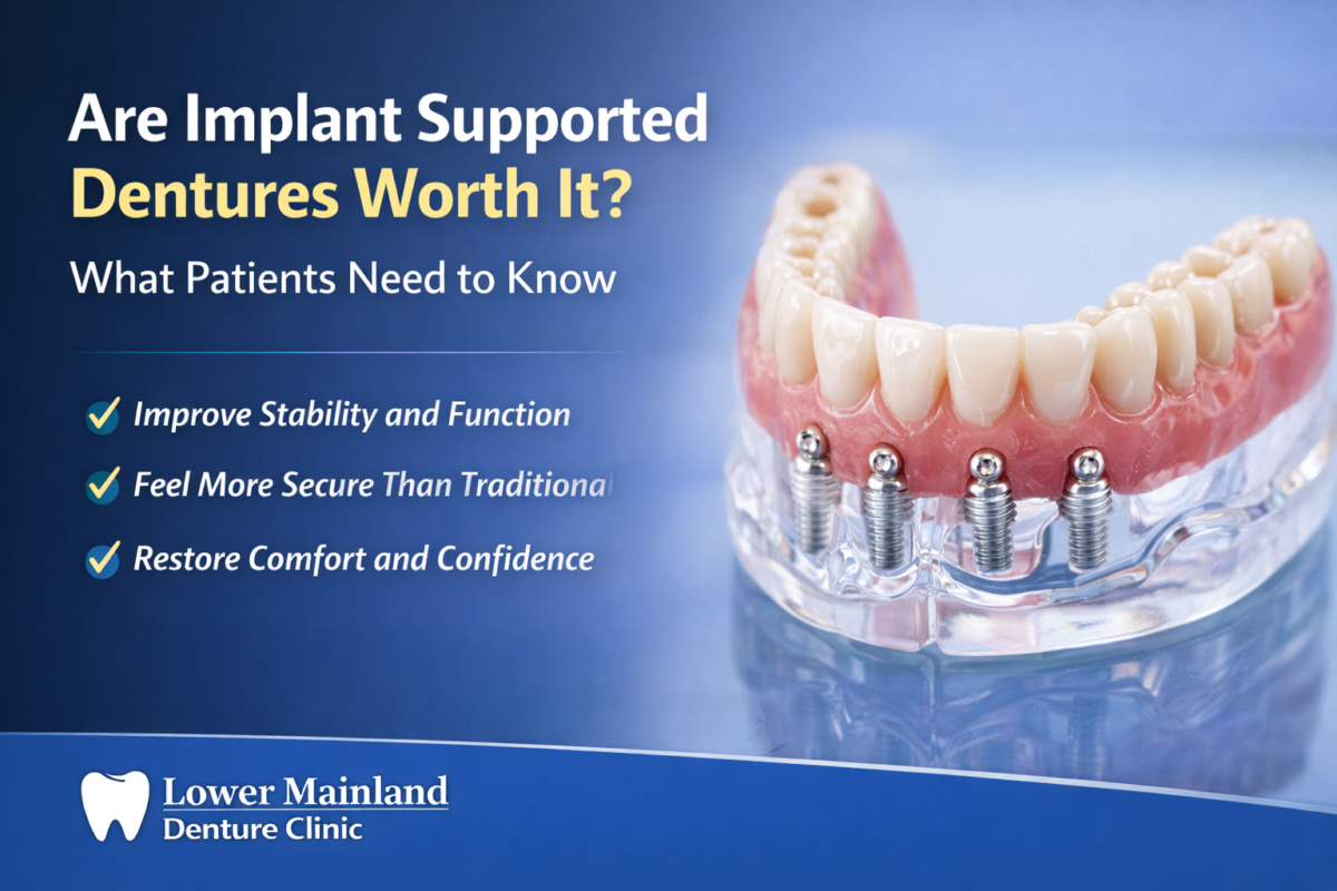 Are Implant Supported Dentures Worth It?