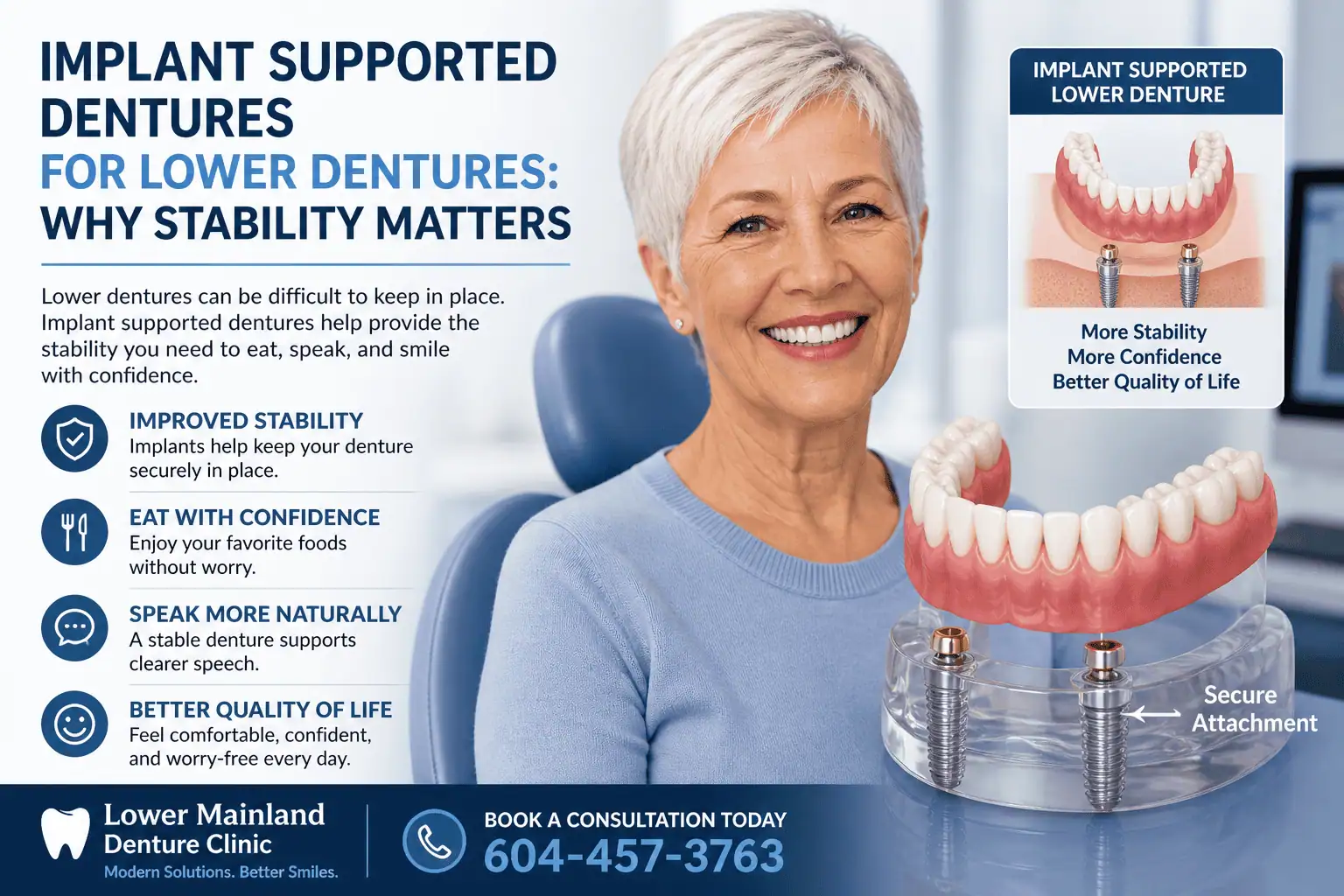 Featured image for “Implant Supported Dentures for Lower Dentures: Why Stability Matters”